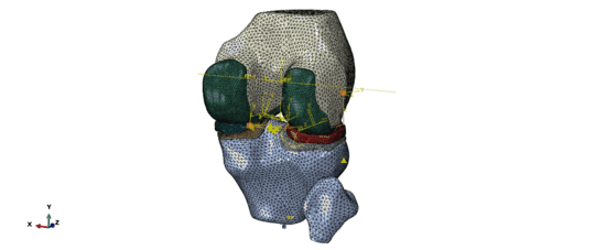 基于ABAQUS自然膝关节步态下接触力学仿真模型