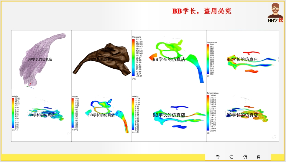 基于Fluent鼻腔流体流动