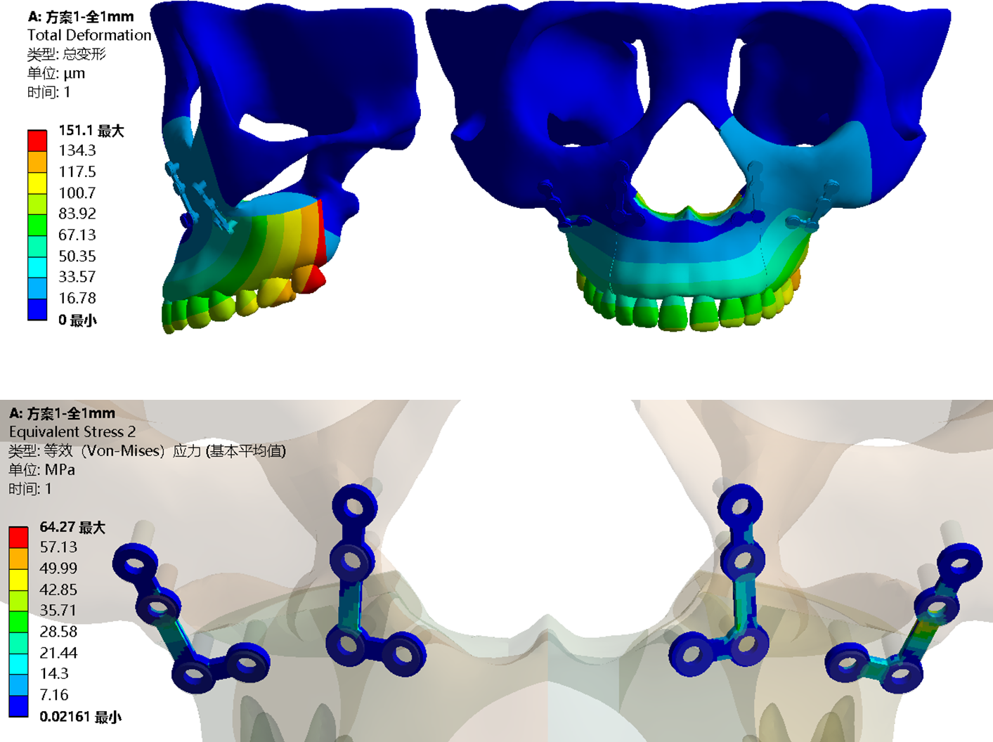 漫谈牙齿正畸与生物医学—ANSYS\Abaqus\HyperMesh口腔生物医学建模与仿真入门