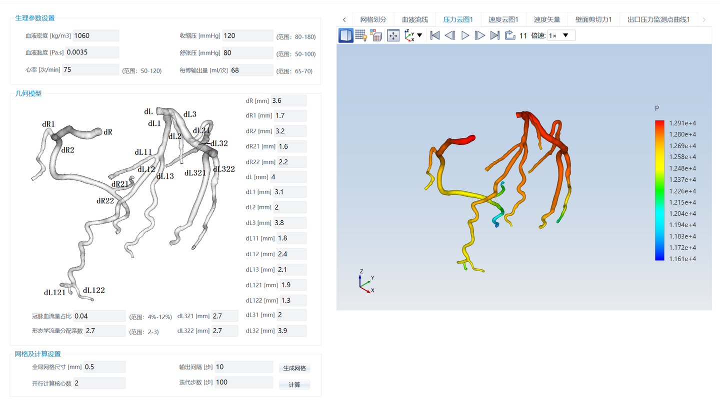 仿真APP应用案例——冠状动脉血流动力学仿真