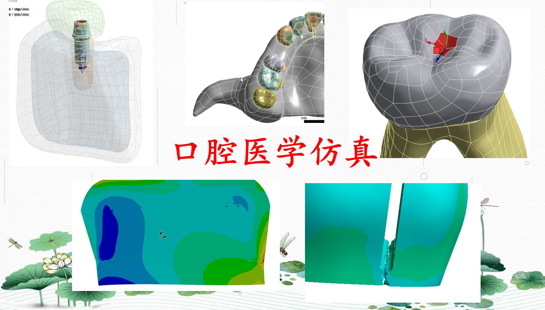 Ansys有限元医学及生物力学仿真综合专题——口腔专业