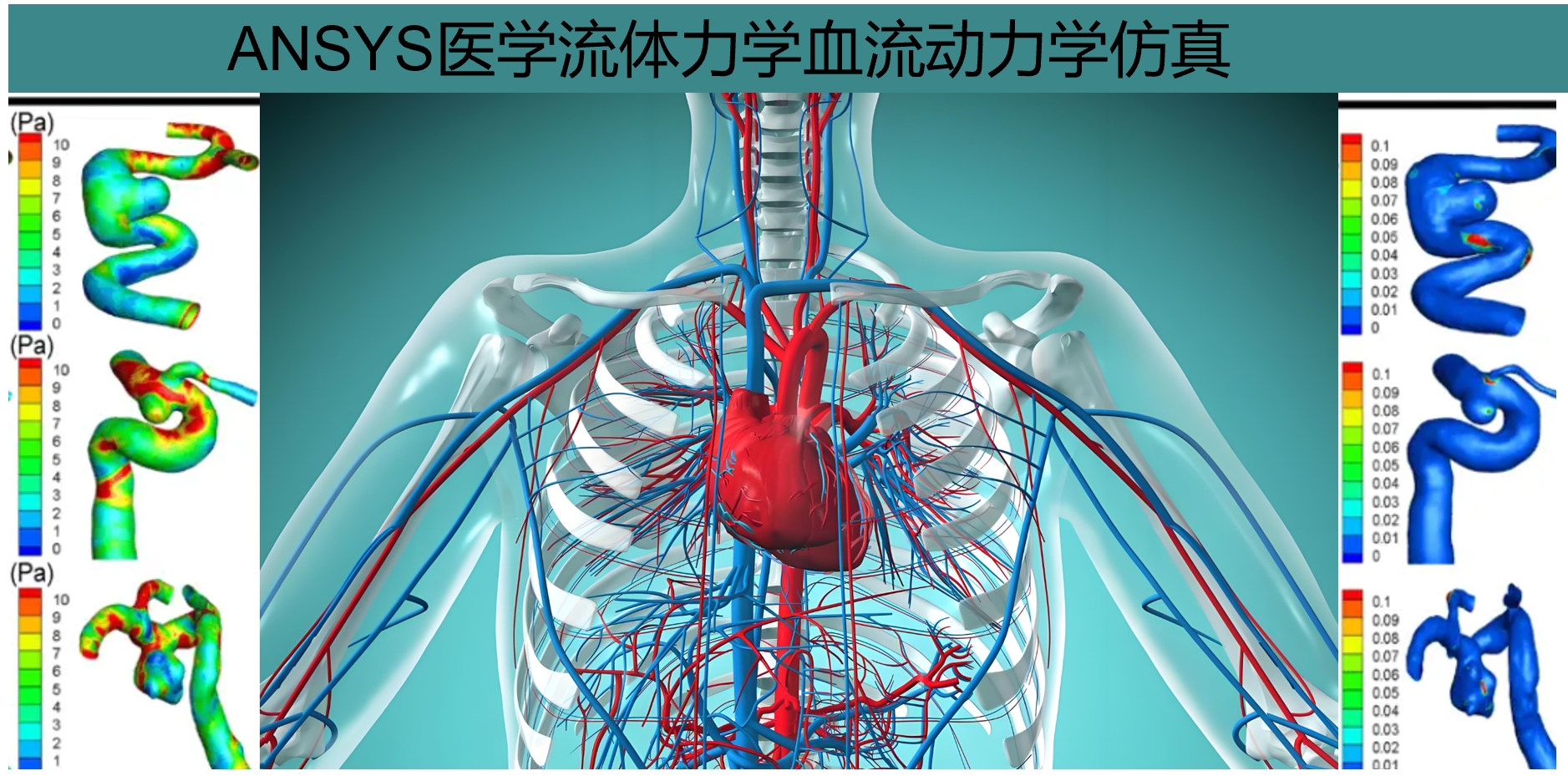 ANSYS医学流体力学血流动力学仿真