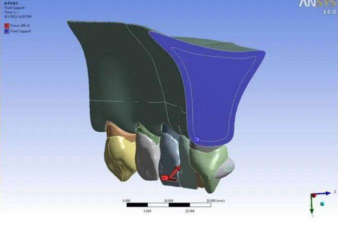 口腔有限元分析