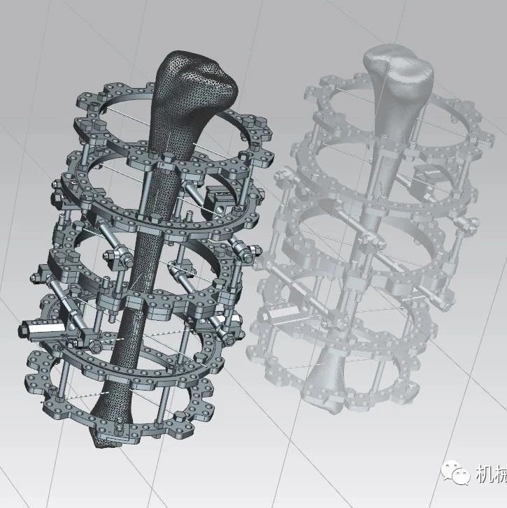 【医疗器械】骨骼复位外固定器3D模型图纸 UG设计