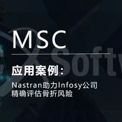 MSC Nastran助力Infosy公司精确评估骨折风险