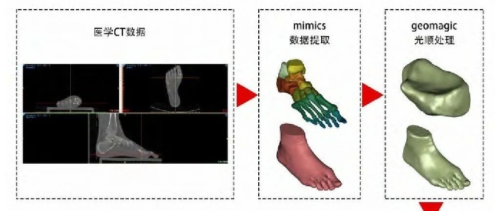 足部有限元分析与研究