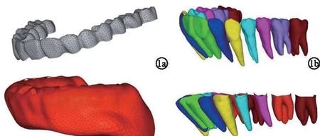 无托槽隐形矫治器联合附件扭转下颌左侧第二前磨牙的三维有限元分析