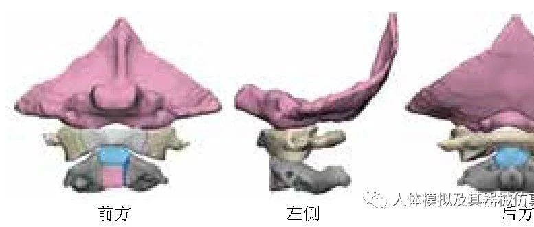 儿童经颈前路内固定的有限元分析