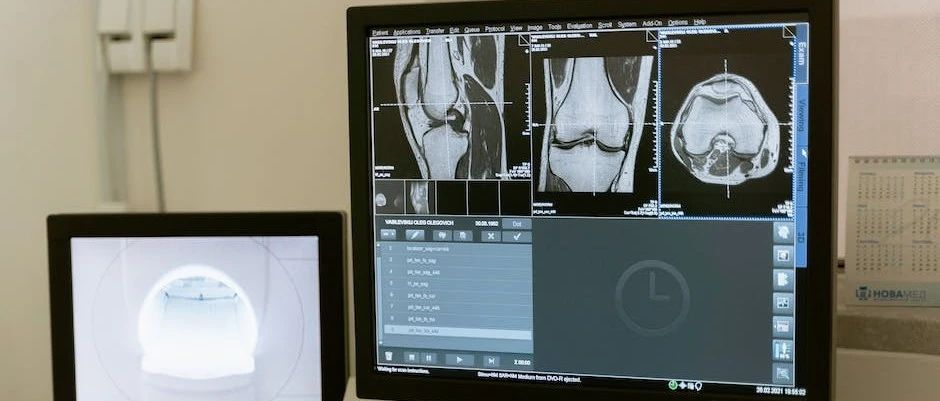 医学生物力学有限元分析流程