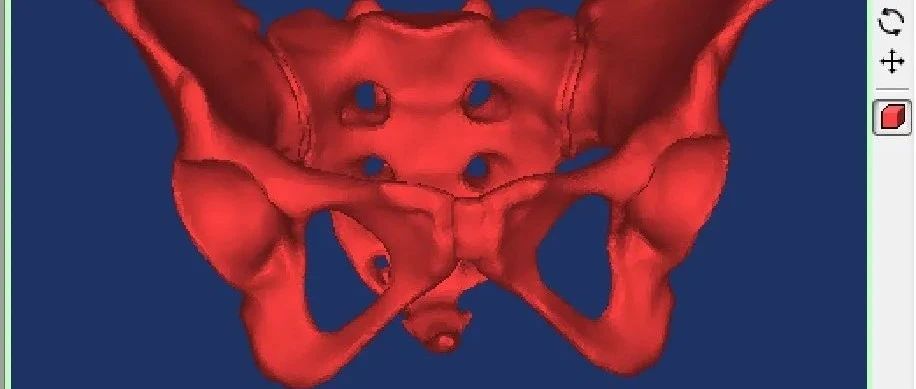 盆骨及腰椎模型构建
