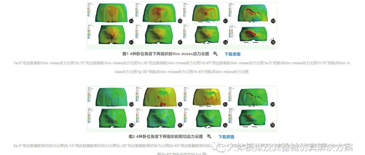 侧卧角度对骶尾部软组织压力的有限元分析