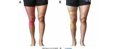 不同运动贴扎技术对跳深着陆时膝关节应力的影响