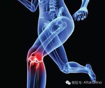 全膝关节置换术后通过对股四头肌肌力进行计算分析来改善患者的膝关节屈曲度