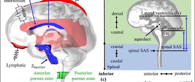 【研究前沿】CFD用来研究咳嗽加剧Chiari I型头痛病情的影响？