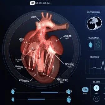 Qt EchoCardio AI 演示：在单一连接的SOM上实现 AI+人机界面（HMI）