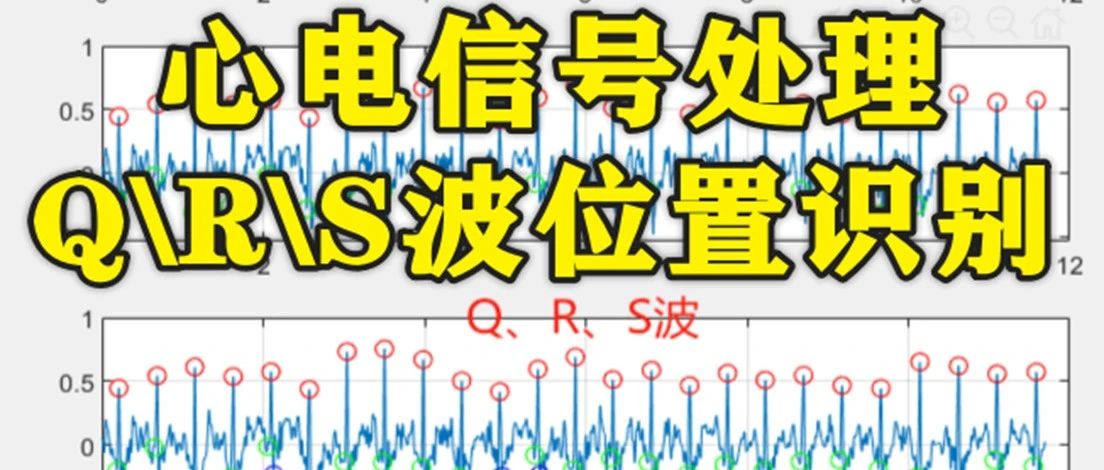1-303基于matlab的心电信号处理