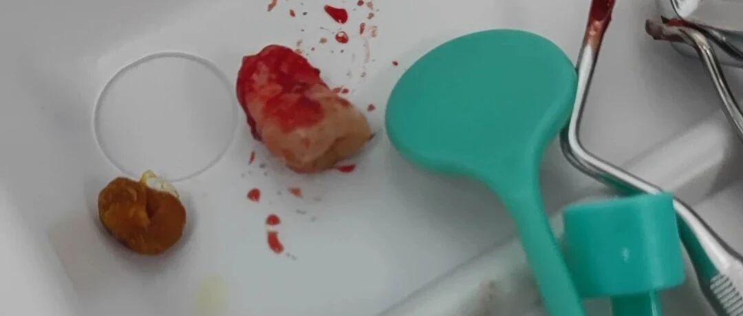 做通信物理层算法的人越来越少，会不会走向绝迹？