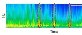 混动系统NVH问题全解析：从"咚咚"异响到"呜呜"啸叫