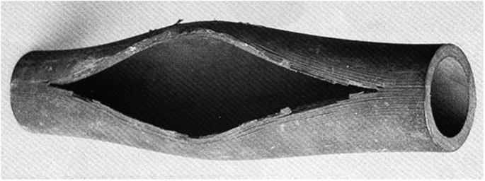 An example of viscoplastic loading that has led to a rupture in the pipe over time