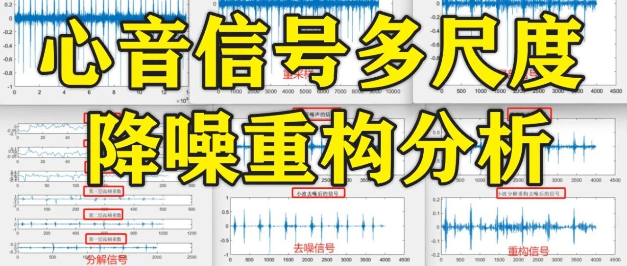 1-327基于matlab的心音信号降噪重构分析