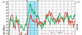 告别“轰隆隆”！工程师如何用“动力吸振器”狙击电动车烦人路噪？