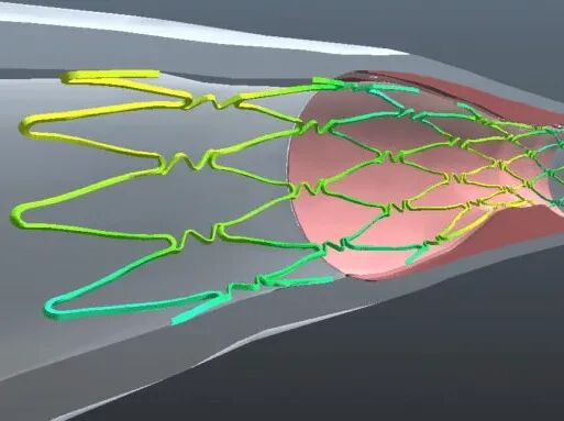 FEA for medical devices
