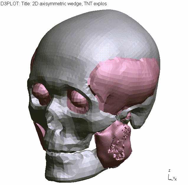 LS-DYNA项目合作、私人订制视频课程、线上培训